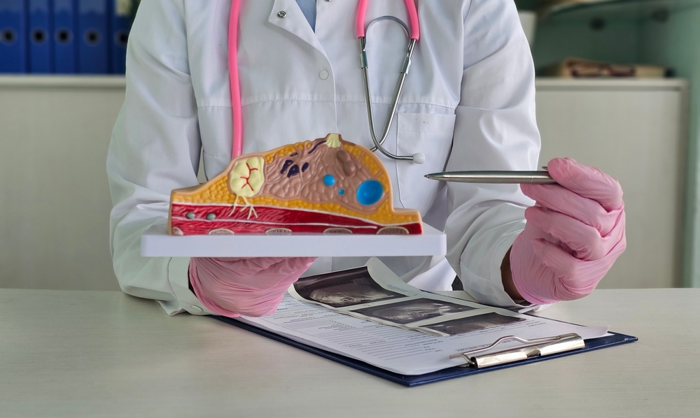 breast care Howard County Maryland