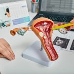 uterine polyps Howard County Maryland